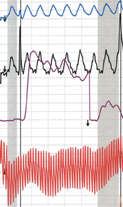 polygraph rental in Camarillo